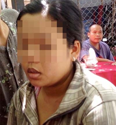 Vụ 3 trẻ tử vong: Sự cố 30 năm chưa từng có của ngành y